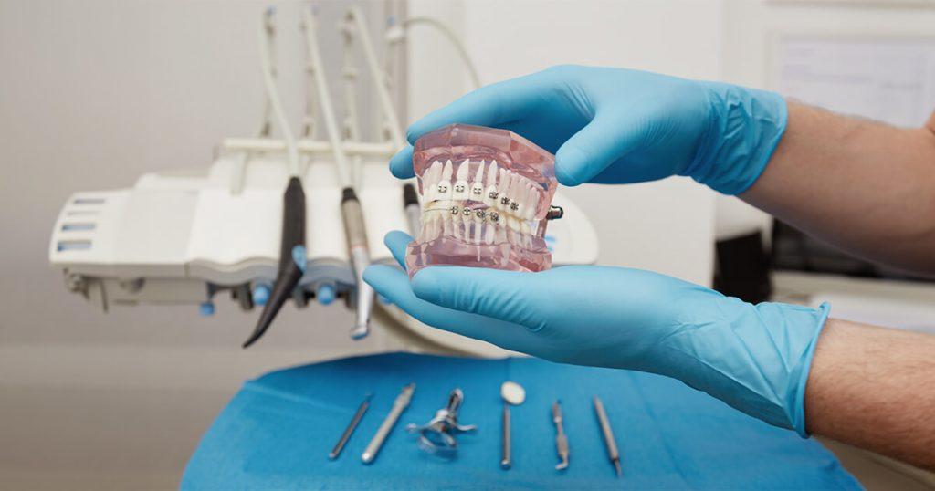 Why Are Dental Implants So Expensive Are There Cheaper Alternatives?