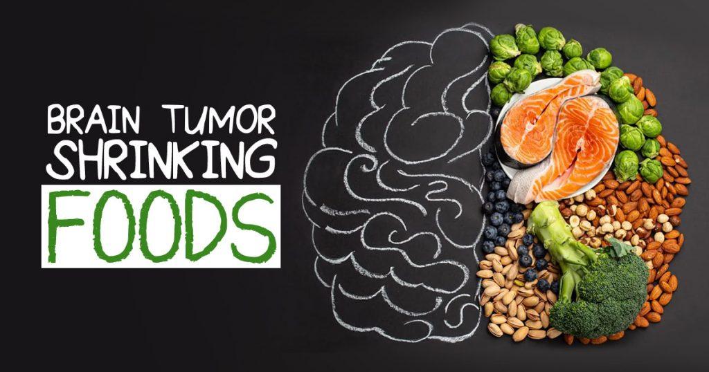 10 Brain Tumor Shrinking Foods - Promoting Brain Health