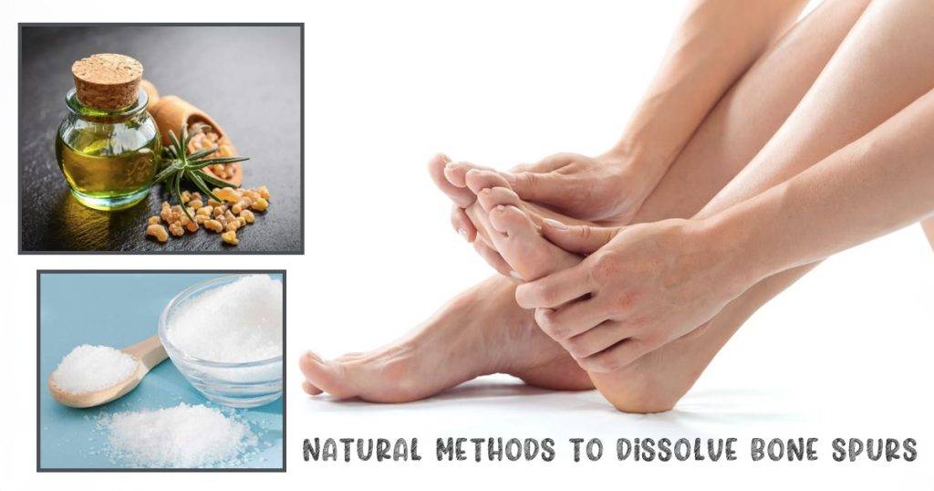 Natural Methods to Dissolve Bone Spurs