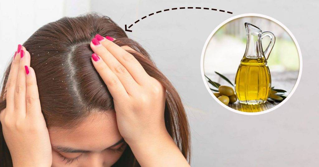 Is Olive Oil Good for Dandruff Solve Dry Scalp