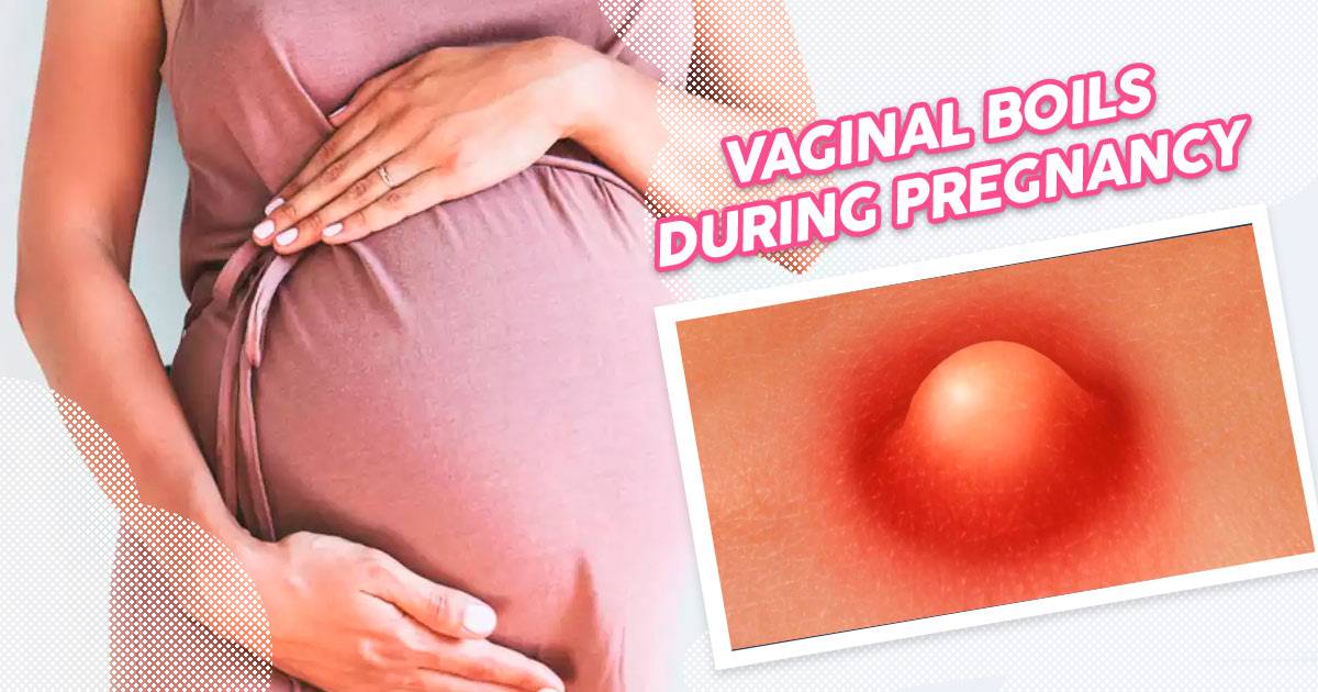 vaginal-boils-during-pregnancy