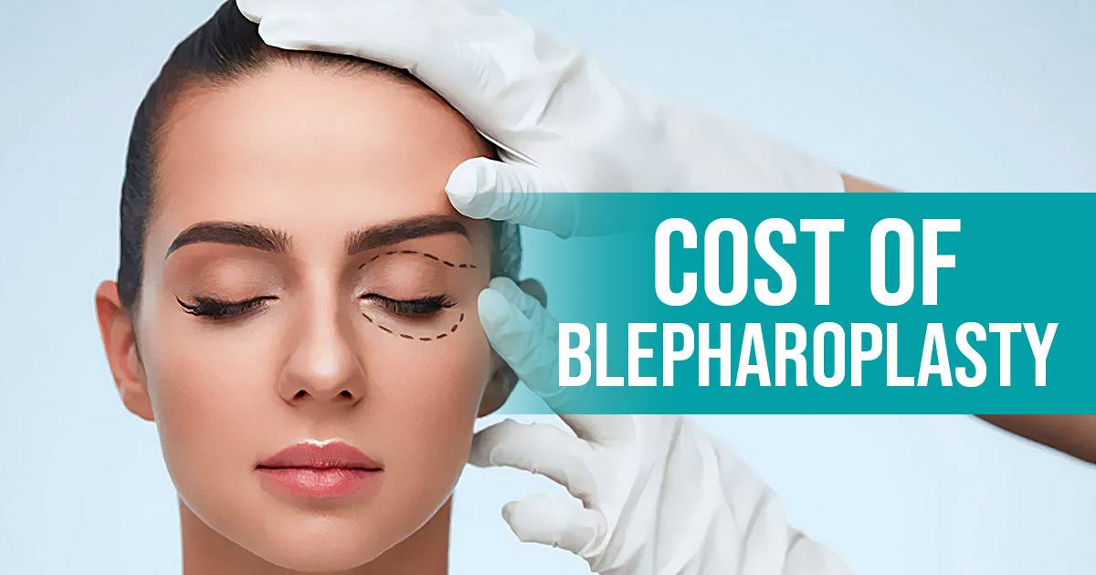 cost of blepharoplasty