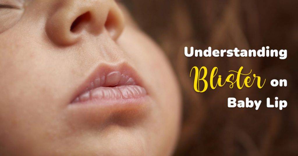 baby-lip-blister-what-to-do