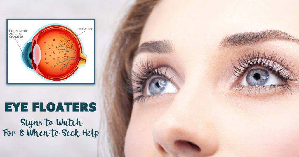 Eye Floaters When Treatment is Necessary