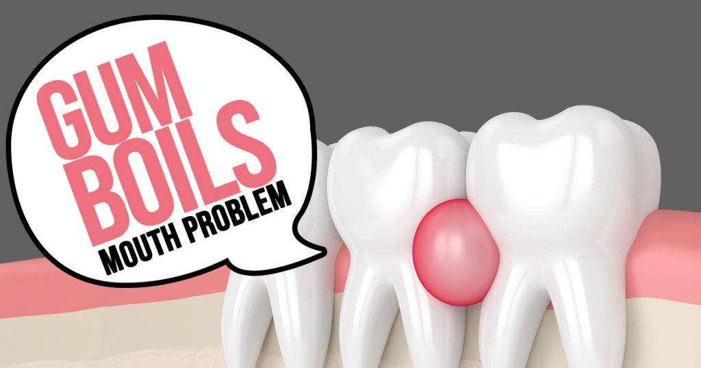 Bumps on your gums? Here are the possible causes