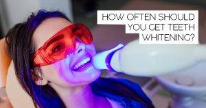 how long does teeth whitening last