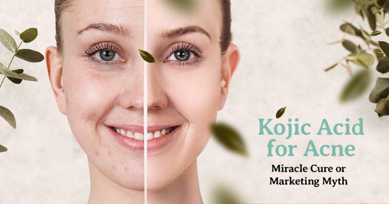 does kojic acid help with acne