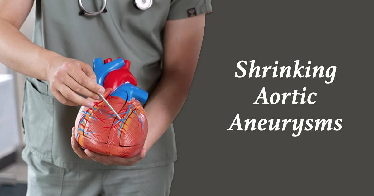 shrinking aortic aneurysms