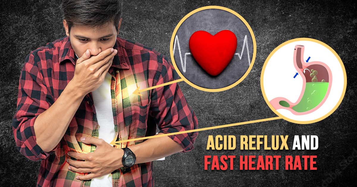 can acid reflux cause heart palpitations