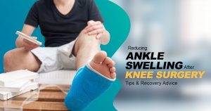 reducing ankle swelling