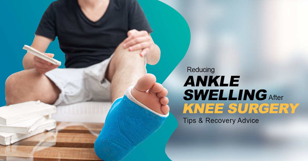 reducing ankle swelling