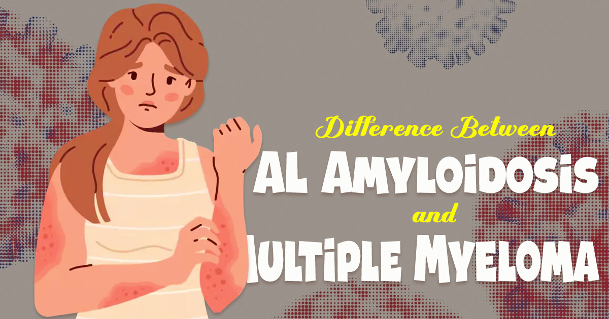 al amyloidosis vs multiple myeloma