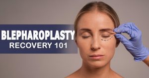 blepharoplasty recovery