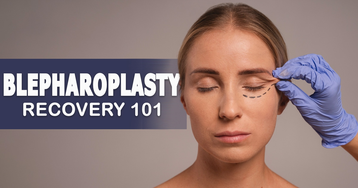 blepharoplasty recovery