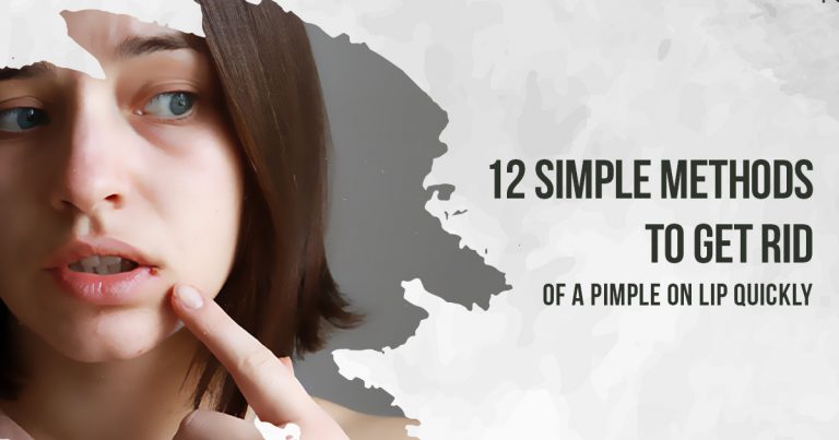How to get rid of pimple on lip