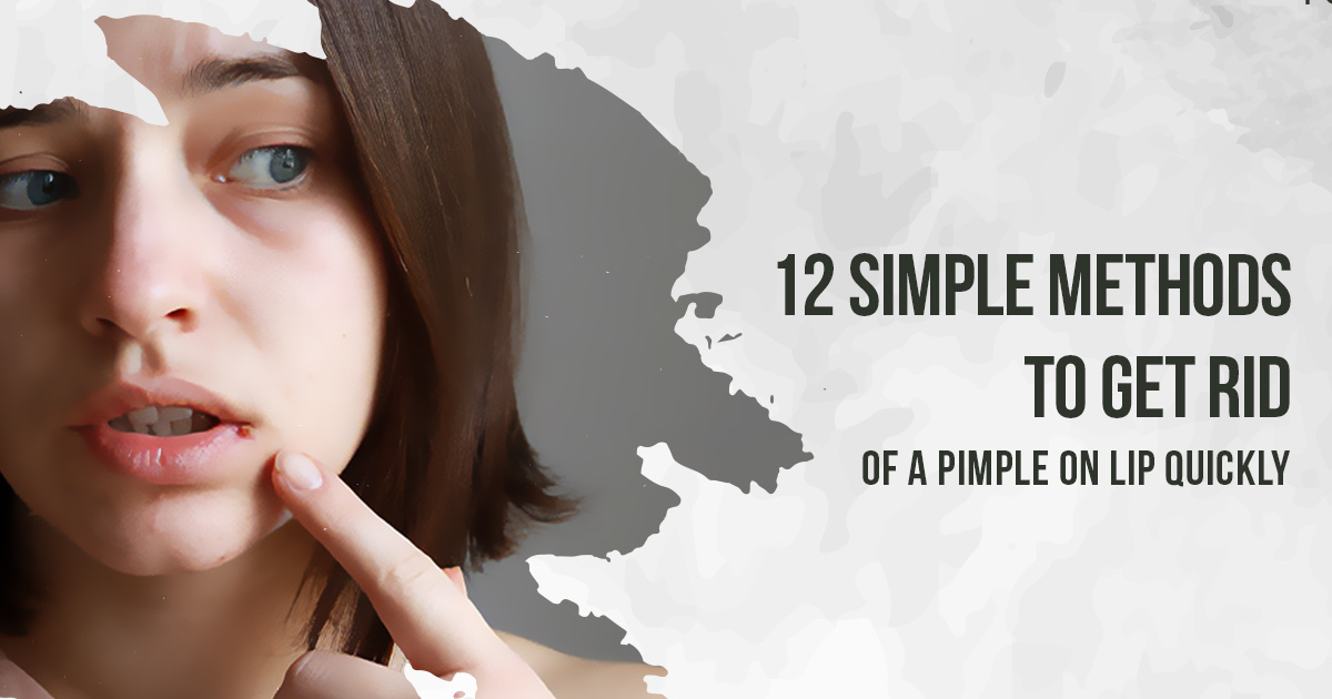 How to get rid of pimple on lip