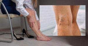 what causes tired legs