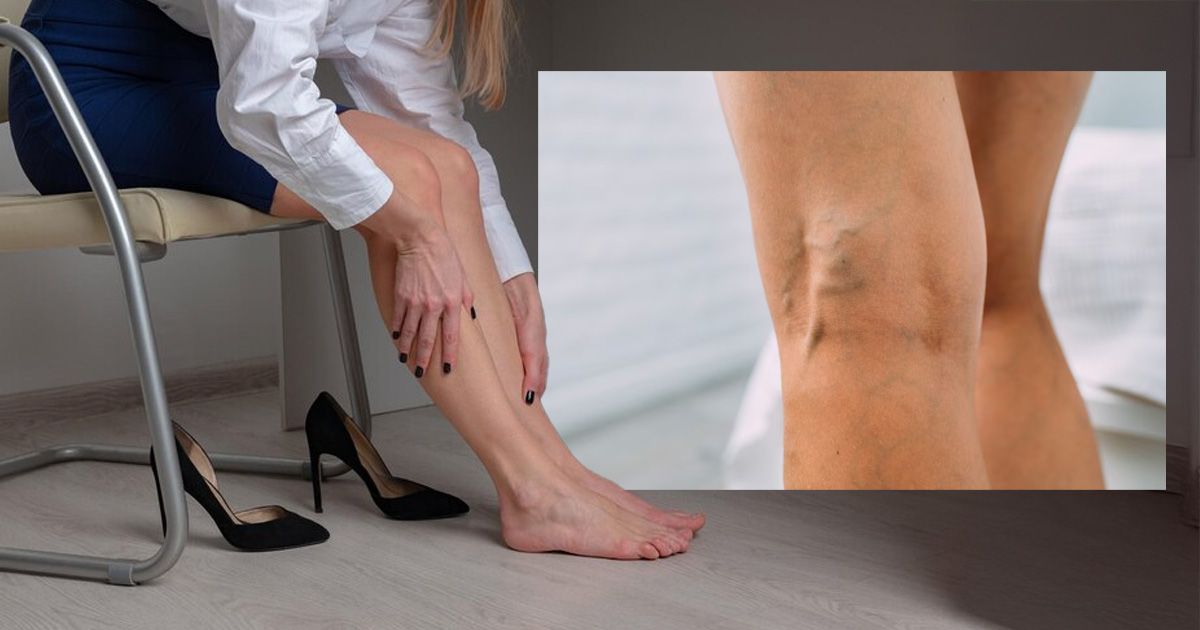 what causes tired legs