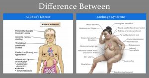 addisons disease and cushings syndrome