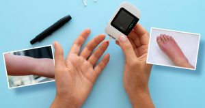 cellulitis for diabetics prevention and care