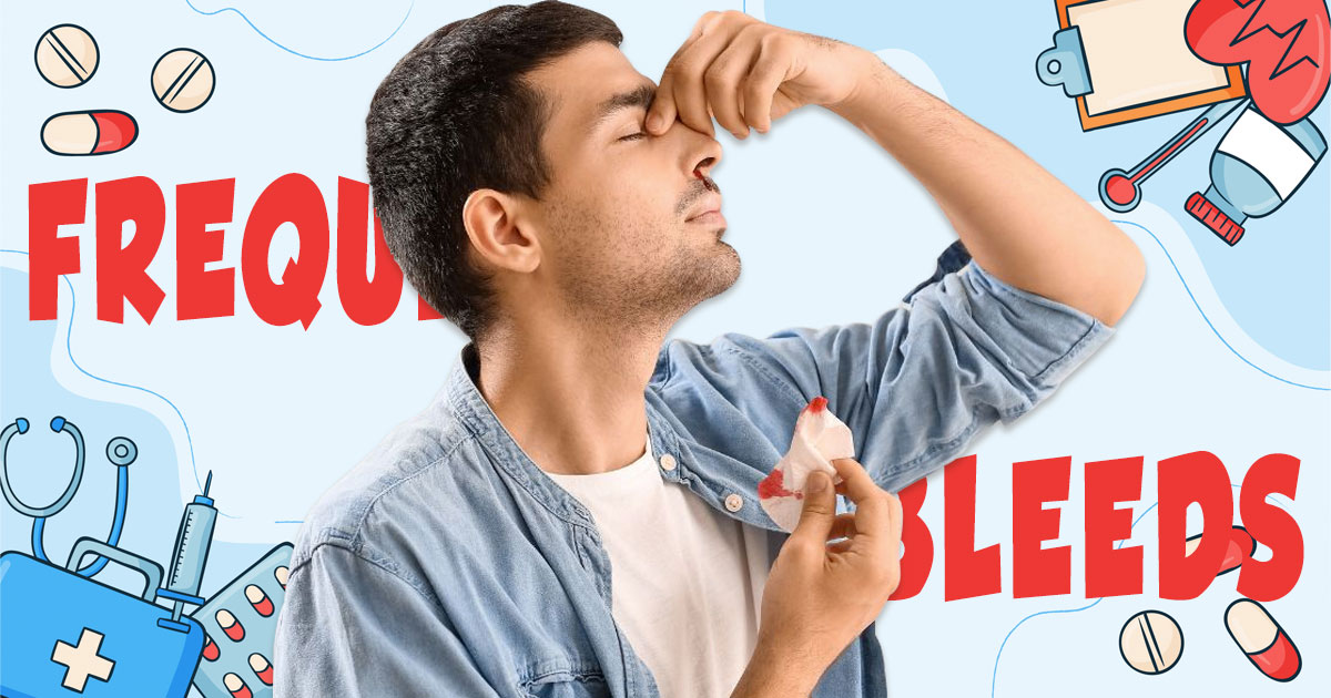 When to worry about a nosebleed